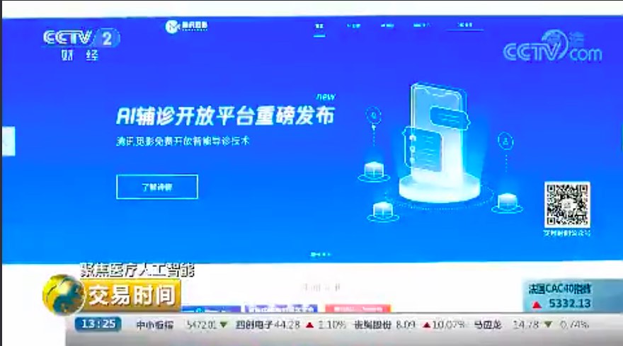 聚焦医疗人工智能 医疗人工智能获投资界青睐 应用成最大难题