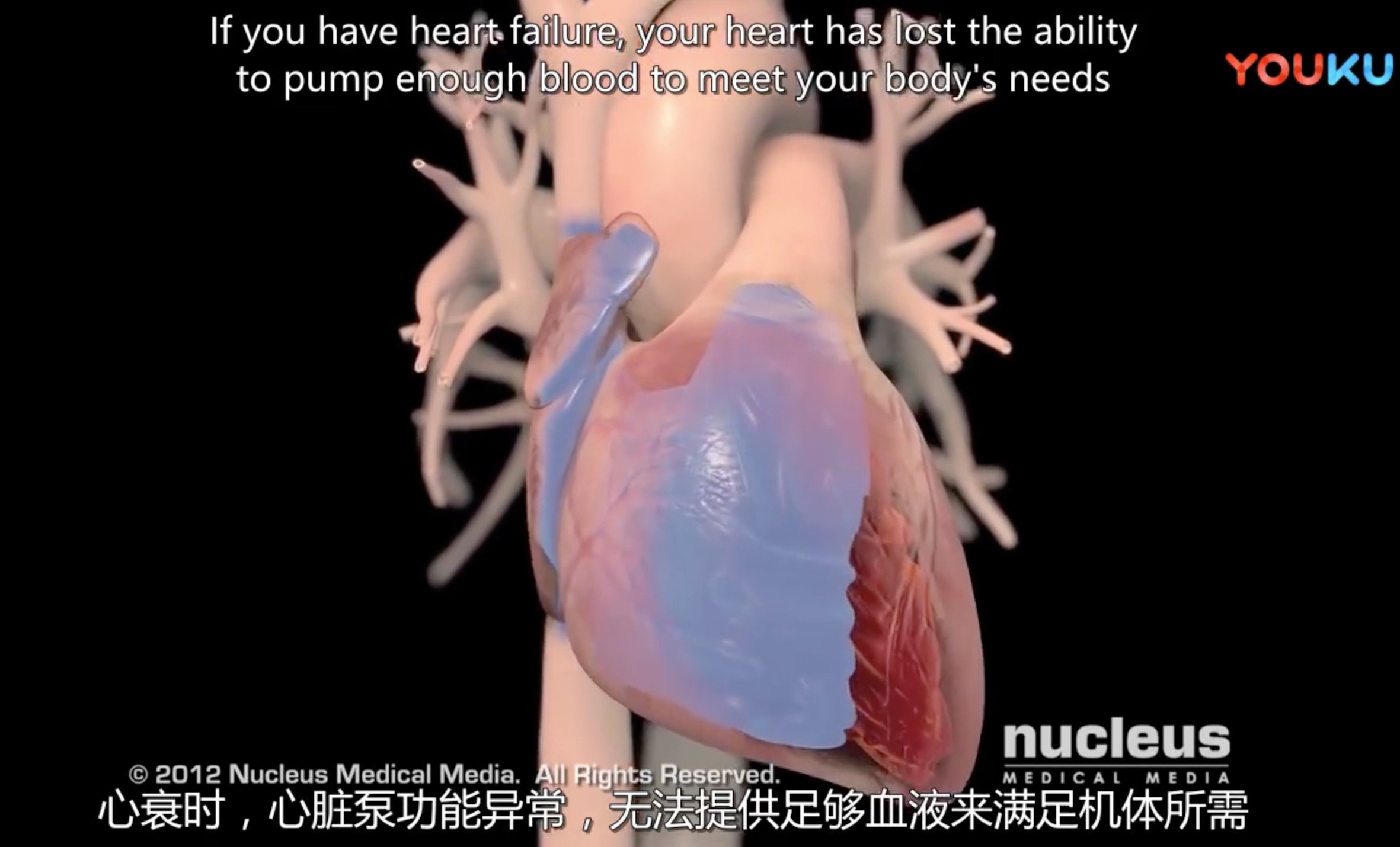 【3D演示】心衰(heart failure)概述