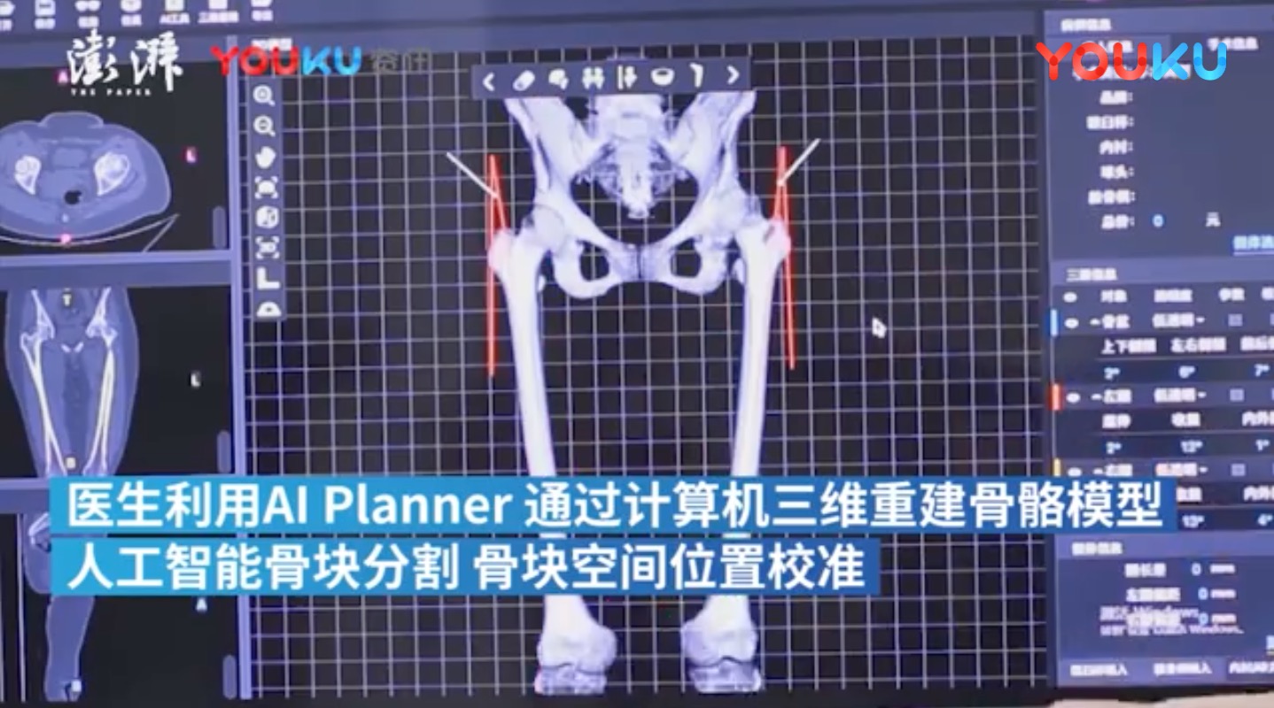 看人工智能如何实现精准医疗