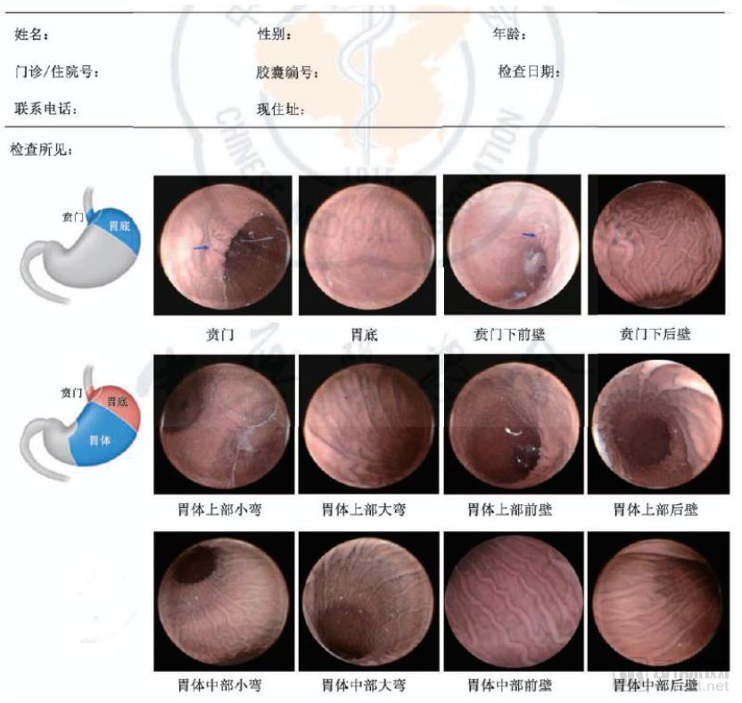 10万胶囊胃镜检查数据透视中国消化道健康状况,探讨器械智能化的社会价值,《中国消化道疾病检查白皮书》发布-肽度TIMEDOO