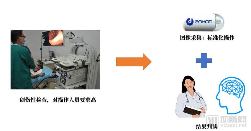 10万胶囊胃镜检查数据透视中国消化道健康状况,探讨器械智能化的社会价值,《中国消化道疾病检查白皮书》发布-肽度TIMEDOO