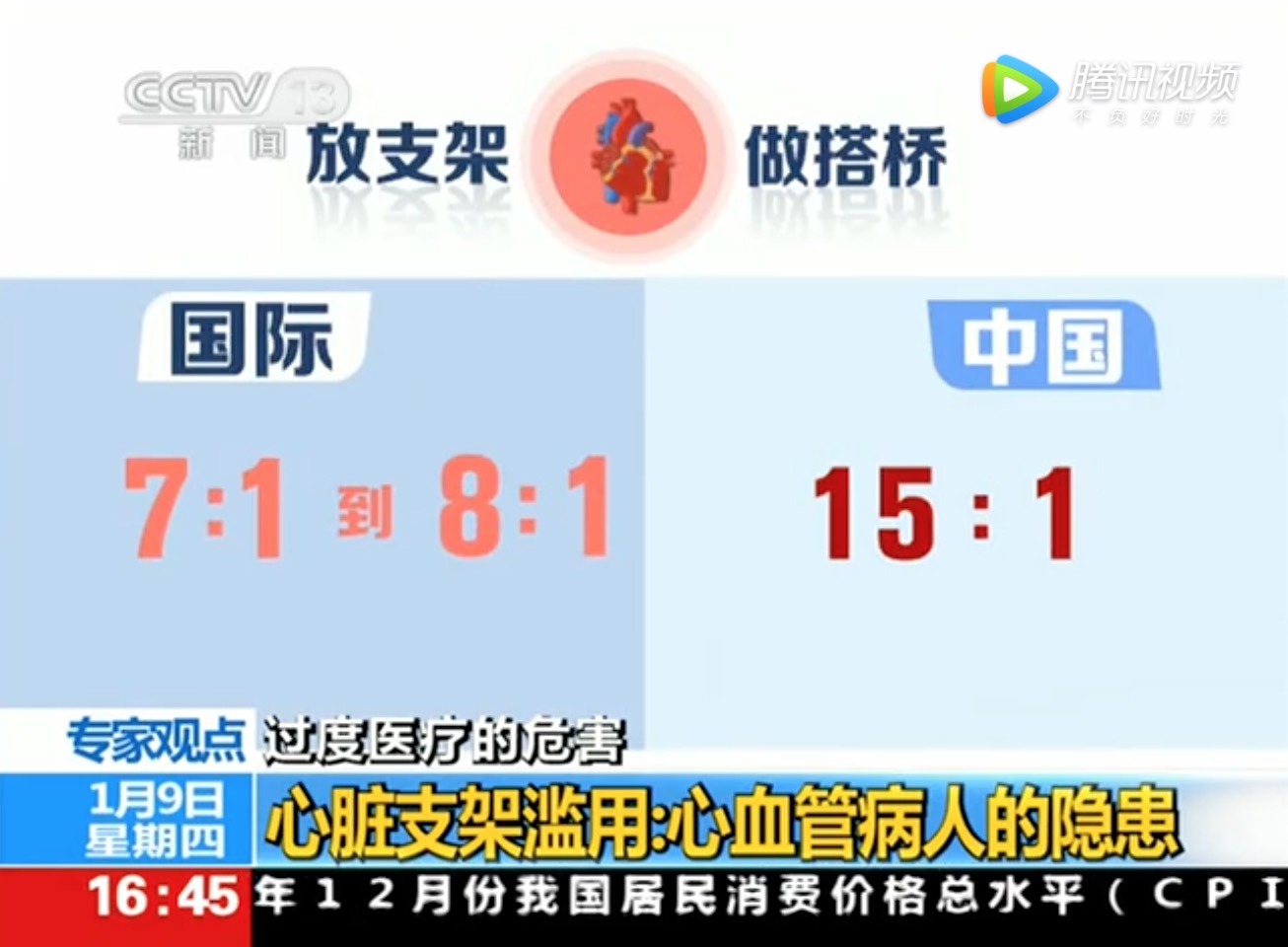 心脏支架滥用的危害