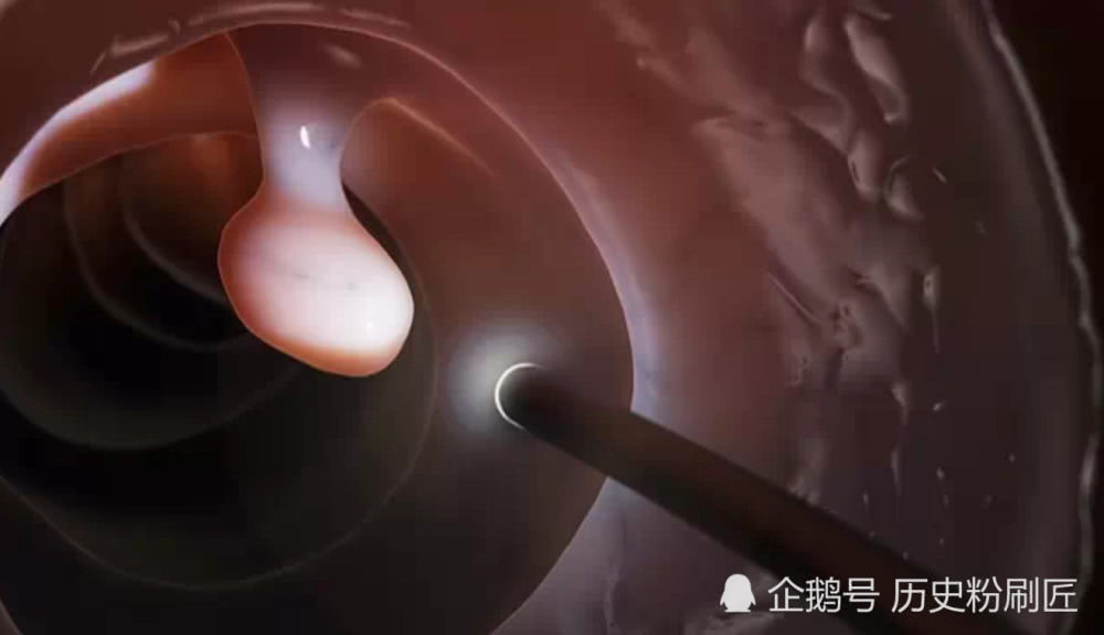 百年抗癌史:人类从来就没有停止对癌症探索的脚步-肽度TIMEDOO