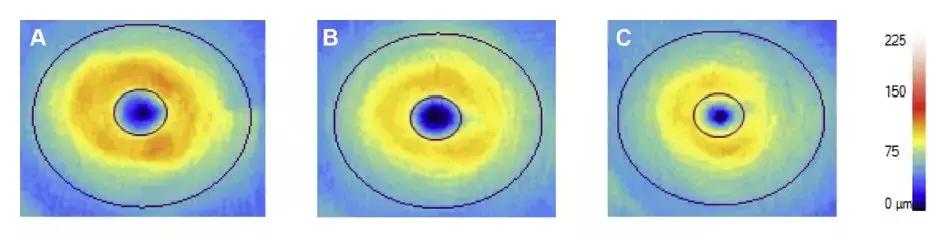 杜克大学最新研究:视网膜血管变化,透露阿尔茨海默症征兆?-肽度TIMEDOO