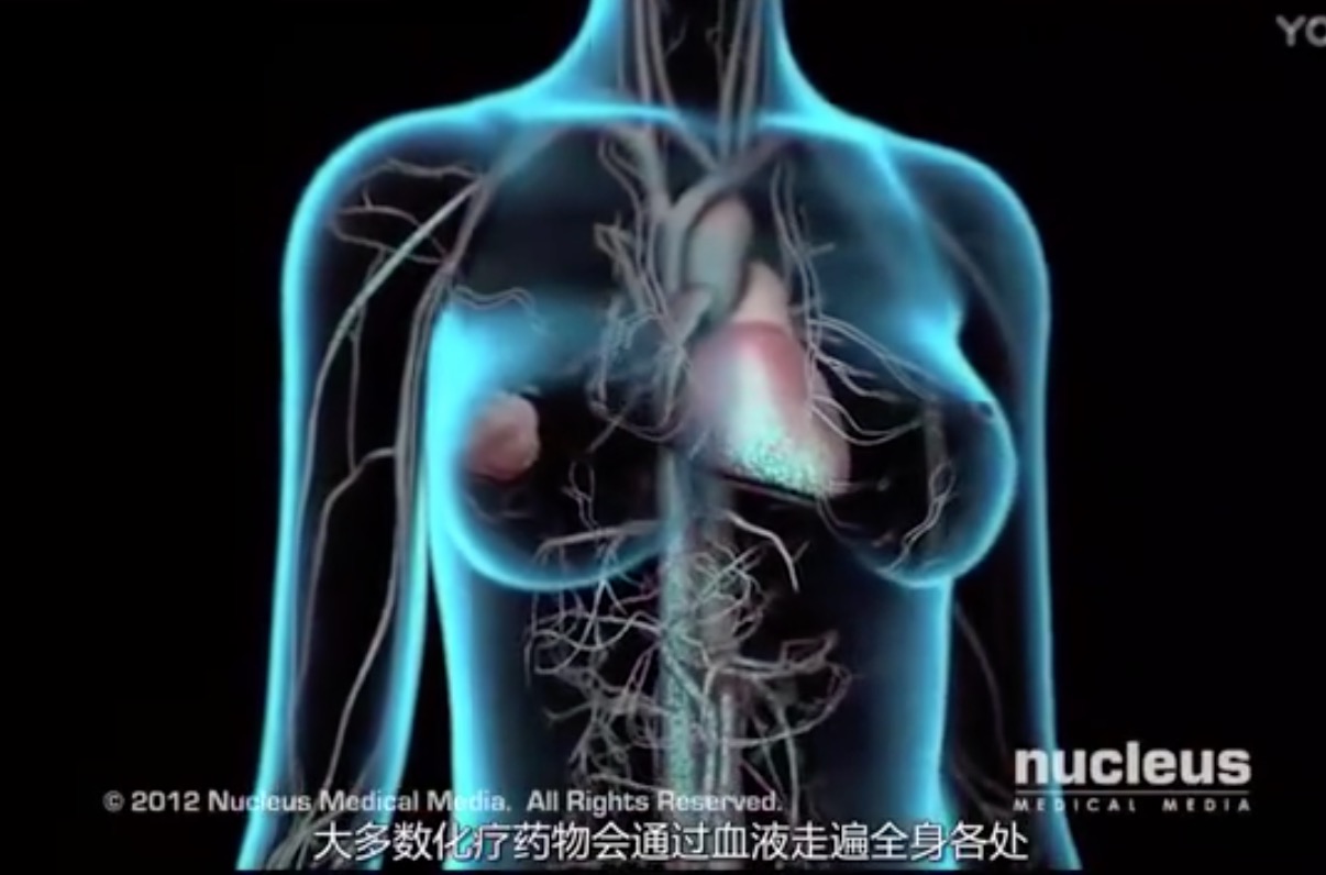 3d演示 癌细胞是如何产生的? 得了癌症为什么要化疗? ​