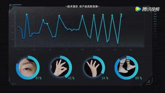 腾讯首部帕金森病纪录片,讲述医学AI背后的故事-肽度TIMEDOO