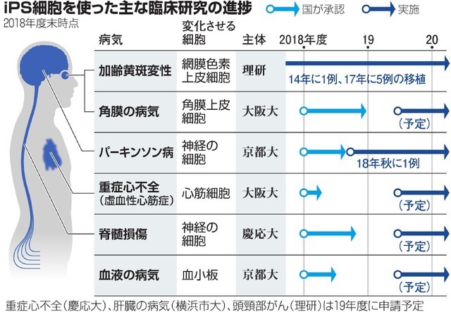 5.jpg 日本研究确认世界首个iPS细胞异体移植手术安全性,但未大幅改善视力-肽度TIMEDOO