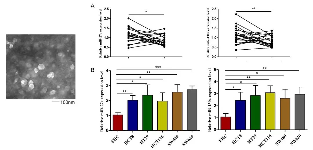 GEO/TCGA数据挖掘：外泌体miRNA轻松发4.5分Biomarker Paper