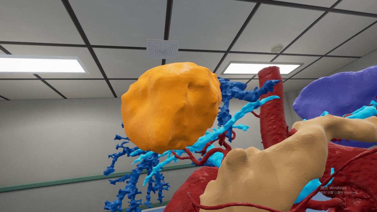 科幻？现实！广州医生演示3D+AR引路手术……