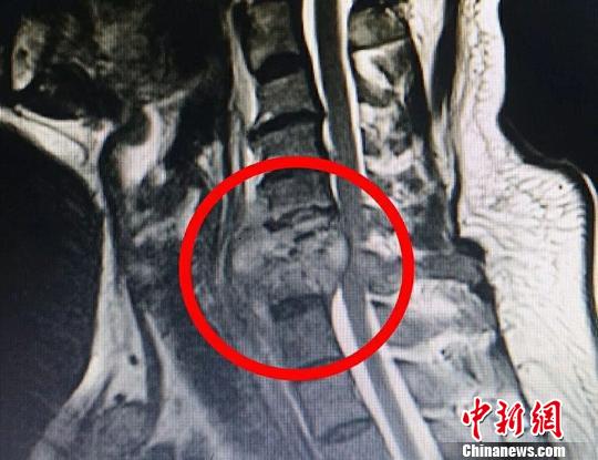 常州医生利用MR技术做手术 宛如科幻大片-肽度TIMEDOO
