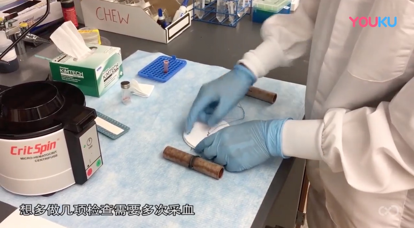 最简易的离心机，只用两张纸片和一根绳，解决落后地区医疗难题