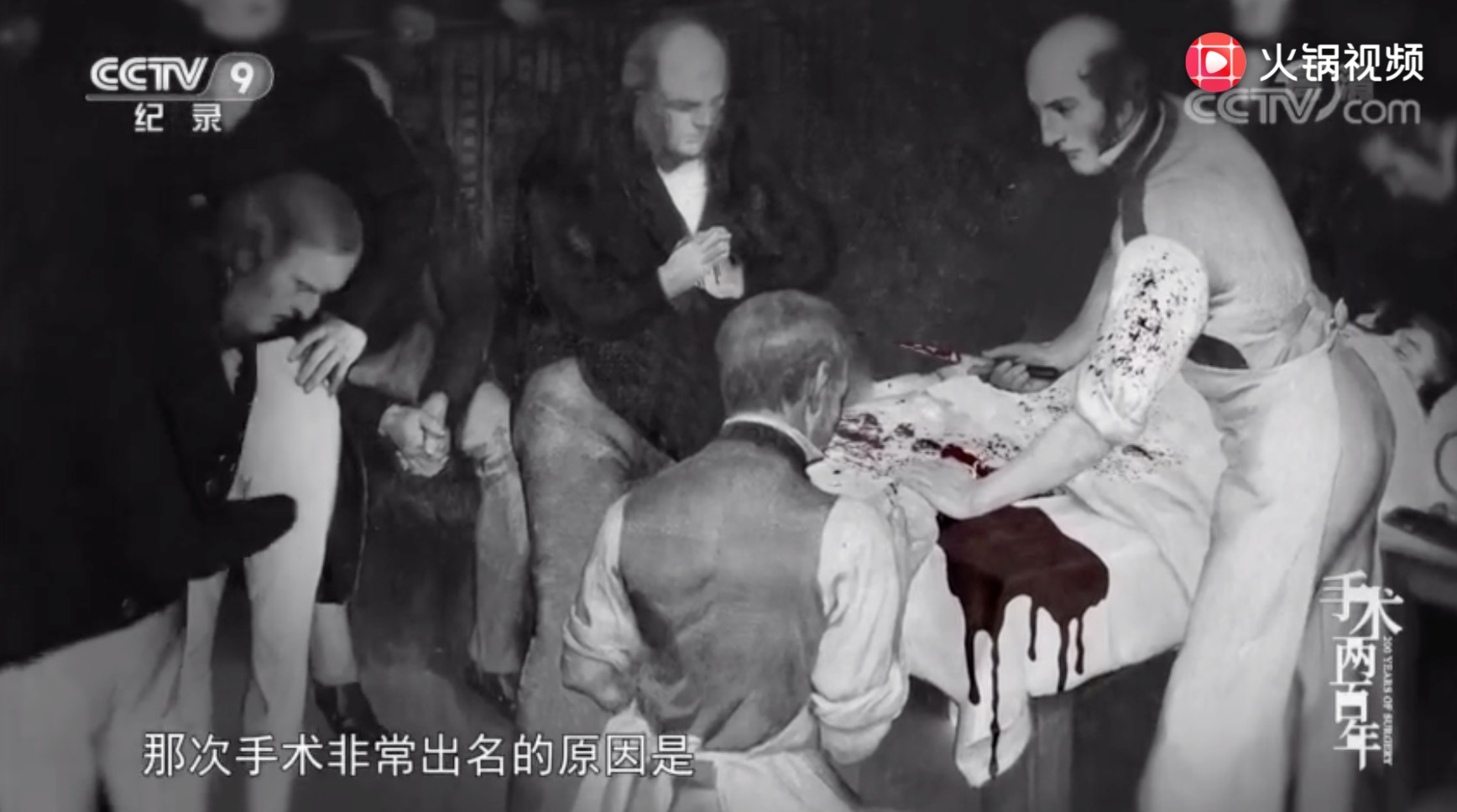 手术两百年|一台手术为何同时死了三个人