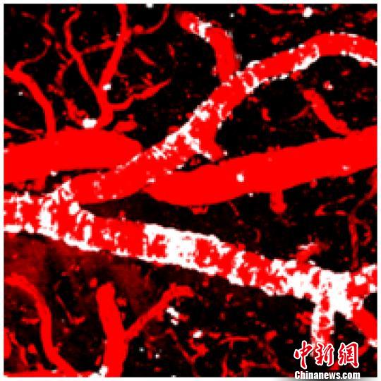中国科学家揭示延缓阿尔茨海默病发病的新机制-肽度TIMEDOO