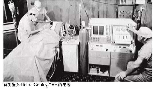 全人工心脏:无数失败中的艰难求索,机械心能否替代生物心?-肽度TIMEDOO
