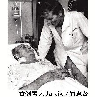 全人工心脏:无数失败中的艰难求索,机械心能否替代生物心?-肽度TIMEDOO