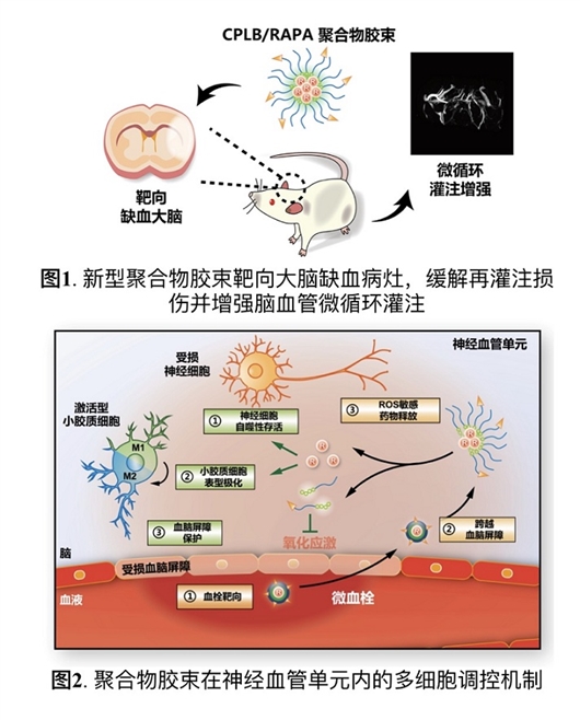 科学家构建靶向治疗缺血型脑卒中胶束递药系统-肽度TIMEDOO