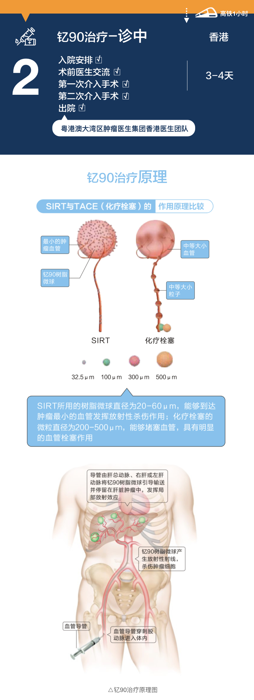 一图读懂肝癌钇90治疗粤港澳大湾区就医攻略-肽度TIMEDOO