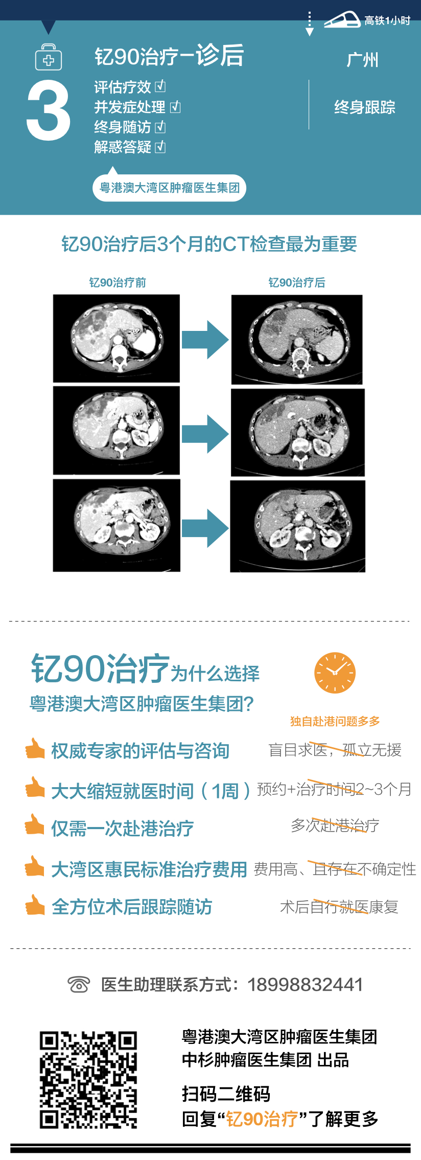 一图读懂肝癌钇90治疗粤港澳大湾区就医攻略-肽度TIMEDOO