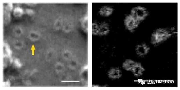 专访|Nature重大发现：癌基因竟不在染色体上？第一作者吴思涵亲身解读！-肽度TIMEDOO