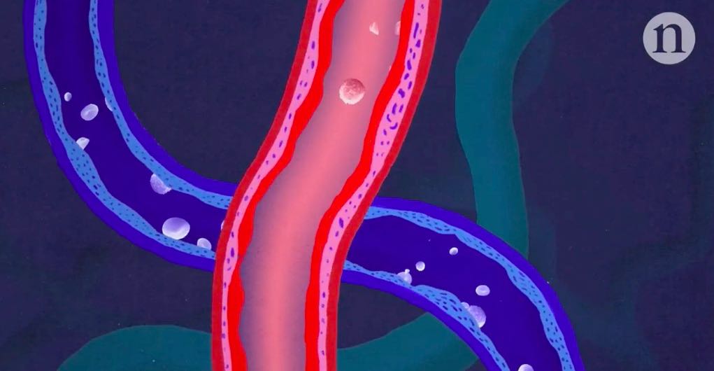 Nature医学动画:通过基因和细胞疗法，刺激新血管的生长