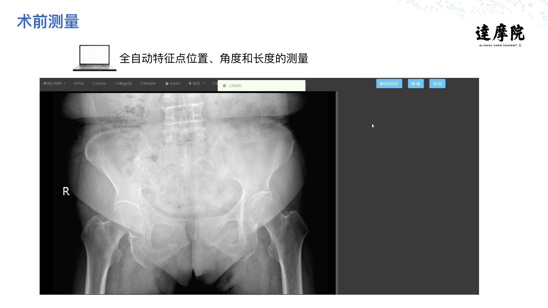 阿里云智能·达摩院|医疗智能实践与探索PPT-肽度TIMEDOO
