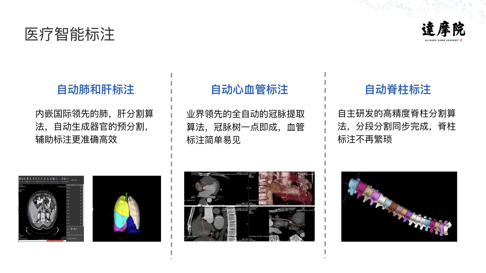 阿里云智能·达摩院|医疗智能实践与探索PPT-肽度TIMEDOO