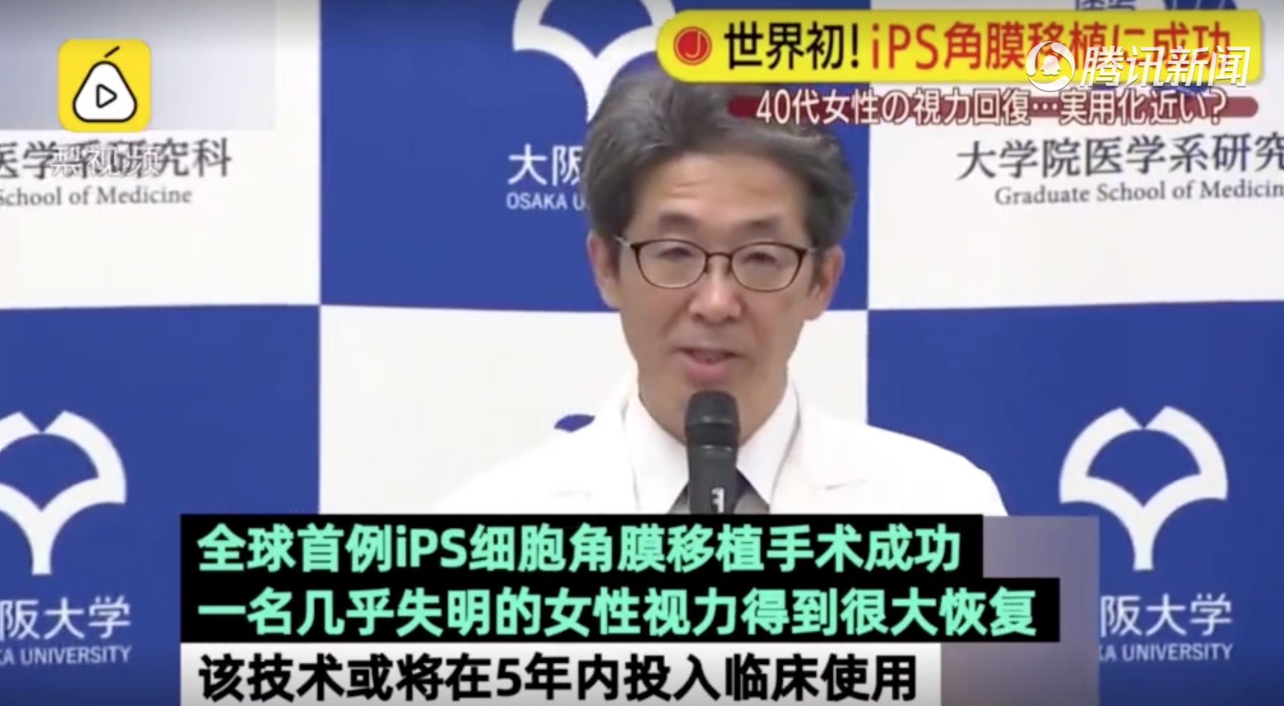 日本实施全球首例iPS细胞角膜移植手术