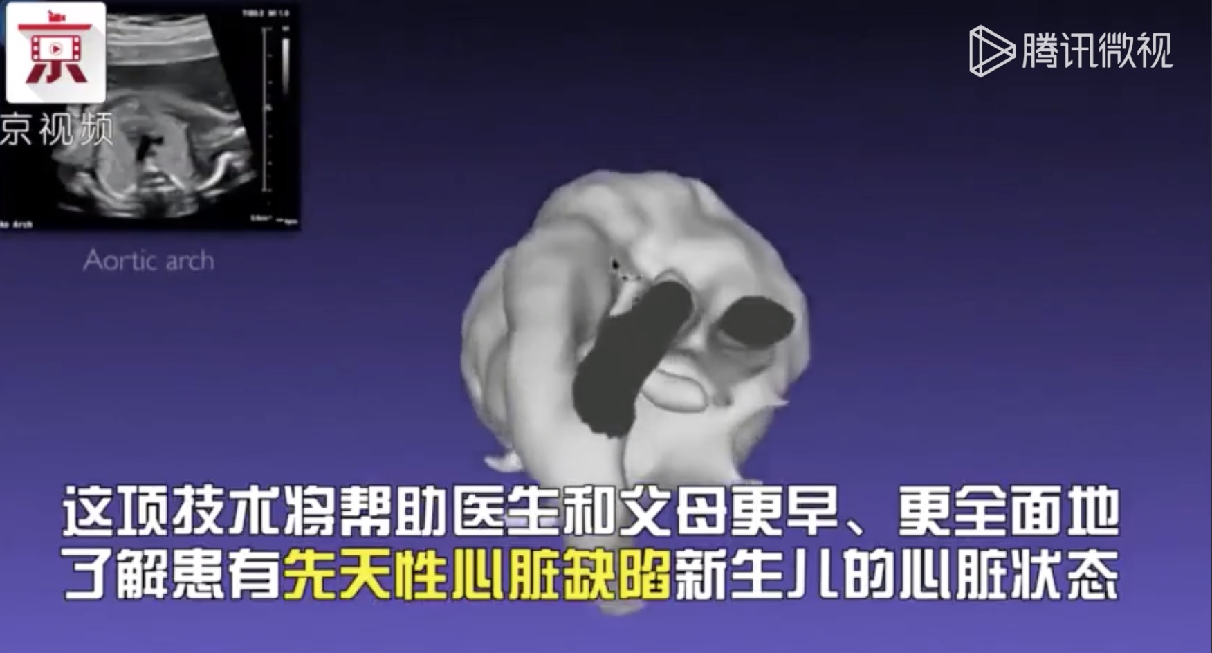 新技术诞生！英国科学家成功获取胎儿心脏3D图像-肽度TIMEDOO