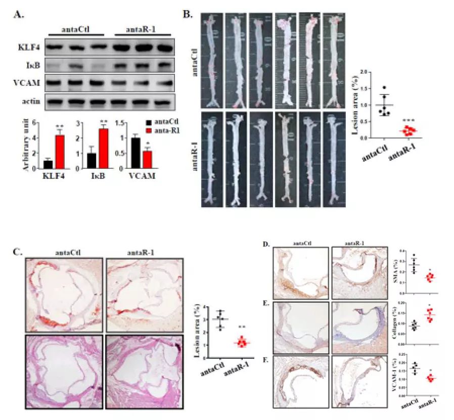 Journal of Hepatology丨肝细胞来源的EVs通过miR-1促进内皮炎症和动脉粥样硬化的新机制-肽度TIMEDOO