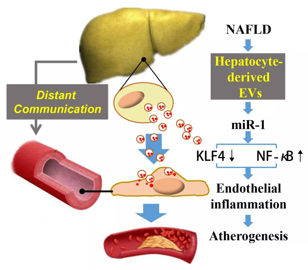 Journal of Hepatology丨肝细胞来源的EVs通过miR-1促进内皮炎症和动脉粥样硬化的新机制-肽度TIMEDOO