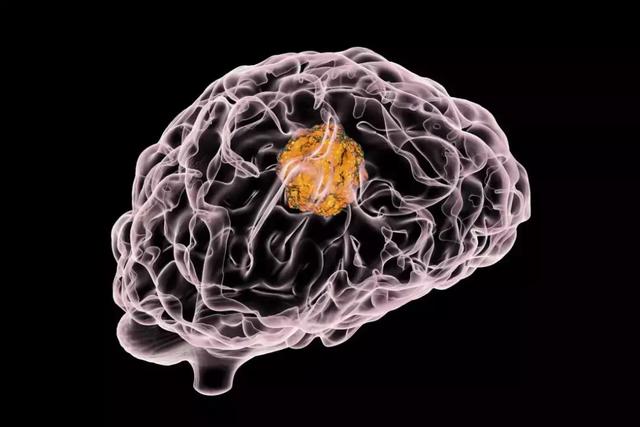 Nature论文发现,癌细胞可“接管”大脑神经元网络,促进肿瘤生长-肽度TIMEDOO