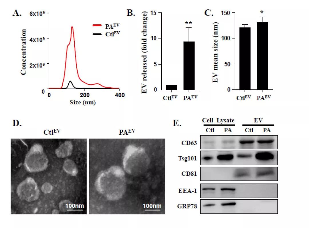 Journal of Hepatology丨肝细胞来源的EVs通过miR-1促进内皮炎症和动脉粥样硬化的新机制-肽度TIMEDOO