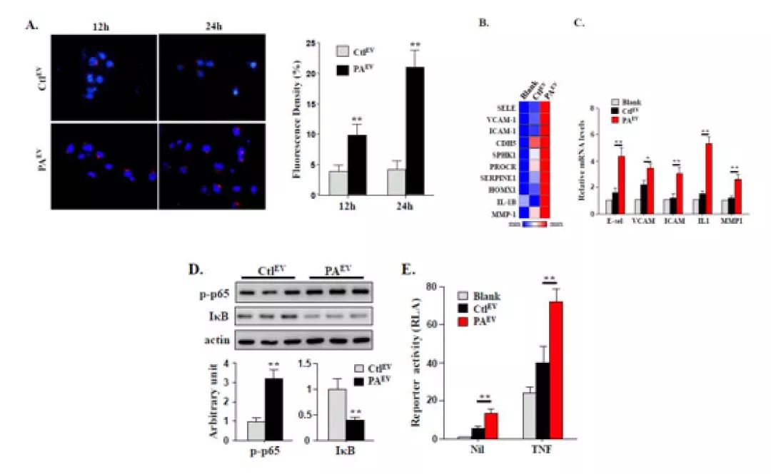Journal of Hepatology丨肝细胞来源的EVs通过miR-1促进内皮炎症和动脉粥样硬化的新机制-肽度TIMEDOO