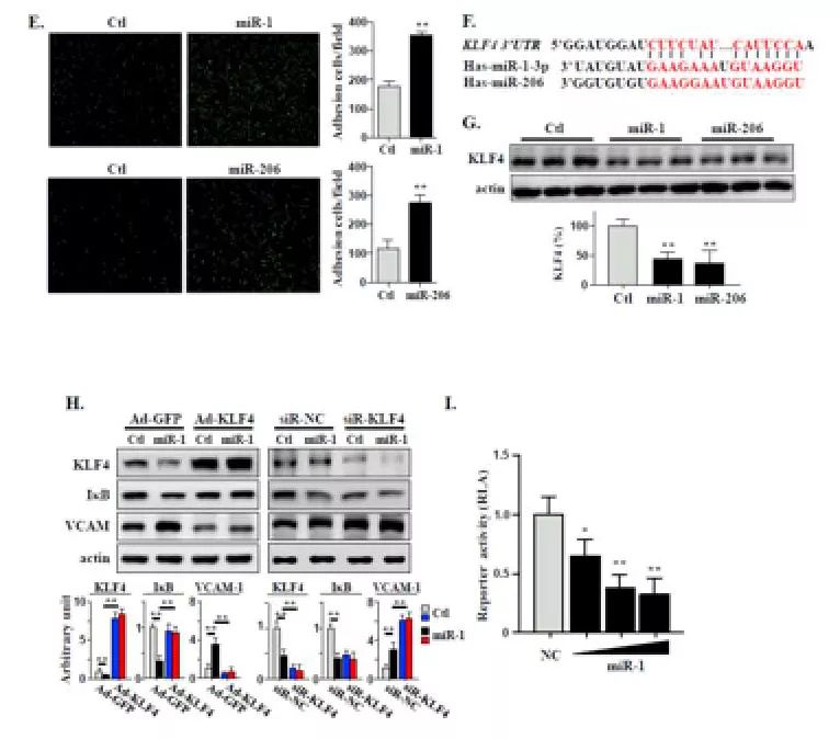 Journal of Hepatology丨肝细胞来源的EVs通过miR-1促进内皮炎症和动脉粥样硬化的新机制-肽度TIMEDOO