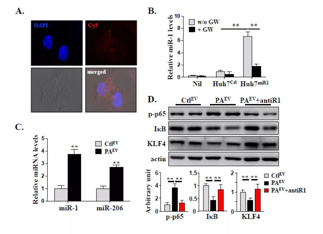 Journal of Hepatology丨肝细胞来源的EVs通过miR-1促进内皮炎症和动脉粥样硬化的新机制-肽度TIMEDOO