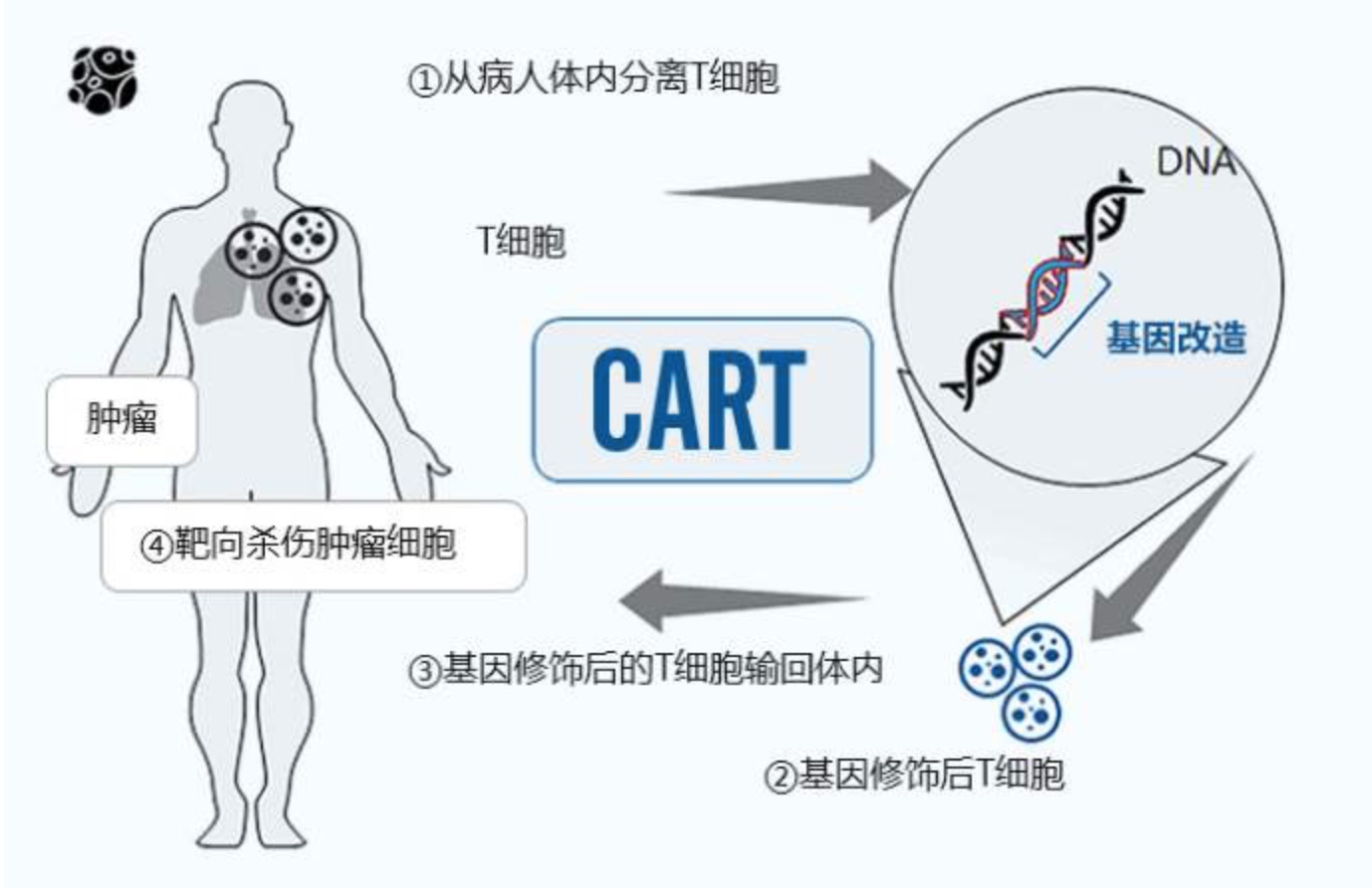 新基因疗法成功挽救淋巴瘤患者