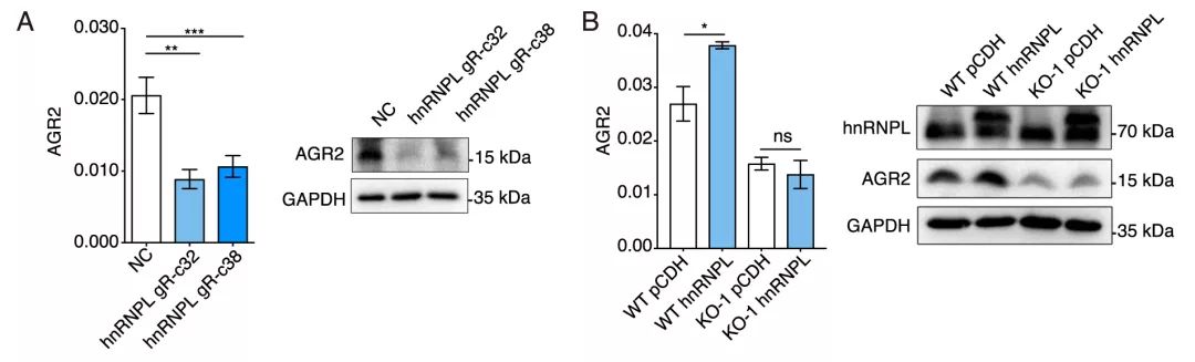 Molecular Cancer丨RiboBio动物用ASO助力发现lncRNA促进乳腺癌转移分子机制-肽度TIMEDOO