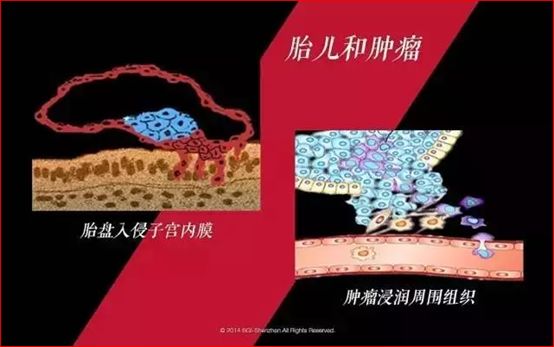 华大基因CEO尹烨：一文读懂肿瘤的过去、现在和未来-肽度TIMEDOO