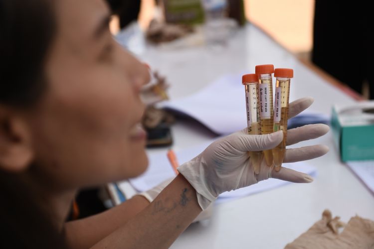荷兰特文特大学：最新光学传感器可检测尿液中低浓度的癌症生物标记