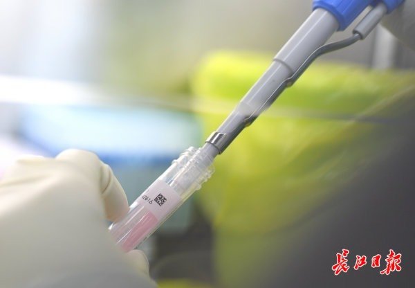 武汉“火眼”实验室开始试运行-肽度TIMEDOO