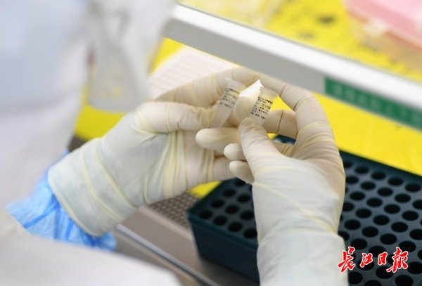 打破核酸检测假阴性困局？抗体诊断试剂已接近临床试验完成阶段！
