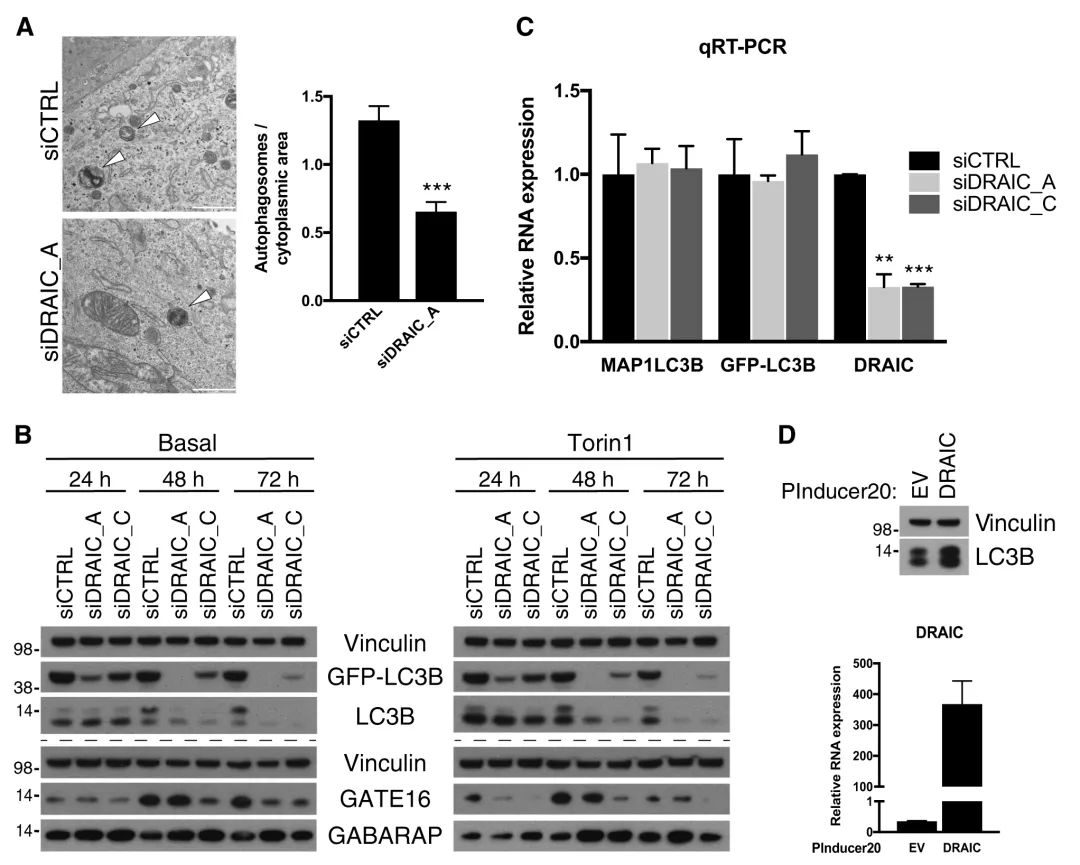 案例解读丨高通量高内涵siRNA文库筛选发现lncRNA DRAIC为新型自噬调节因子-肽度TIMEDOO