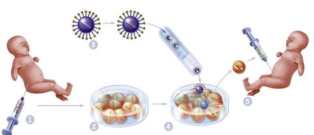 Memorial Sloan Kettering:CAR-T除了抗癌,还能抗衰老?-肽度TIMEDOO