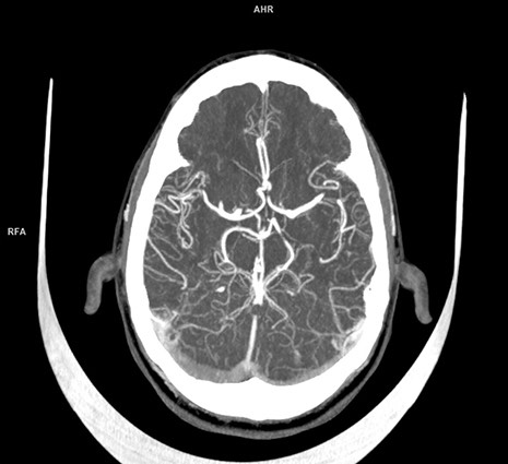 西门子医疗:Somatom On.site便携式CT扫描仪获得FDA批准-肽度TIMEDOO