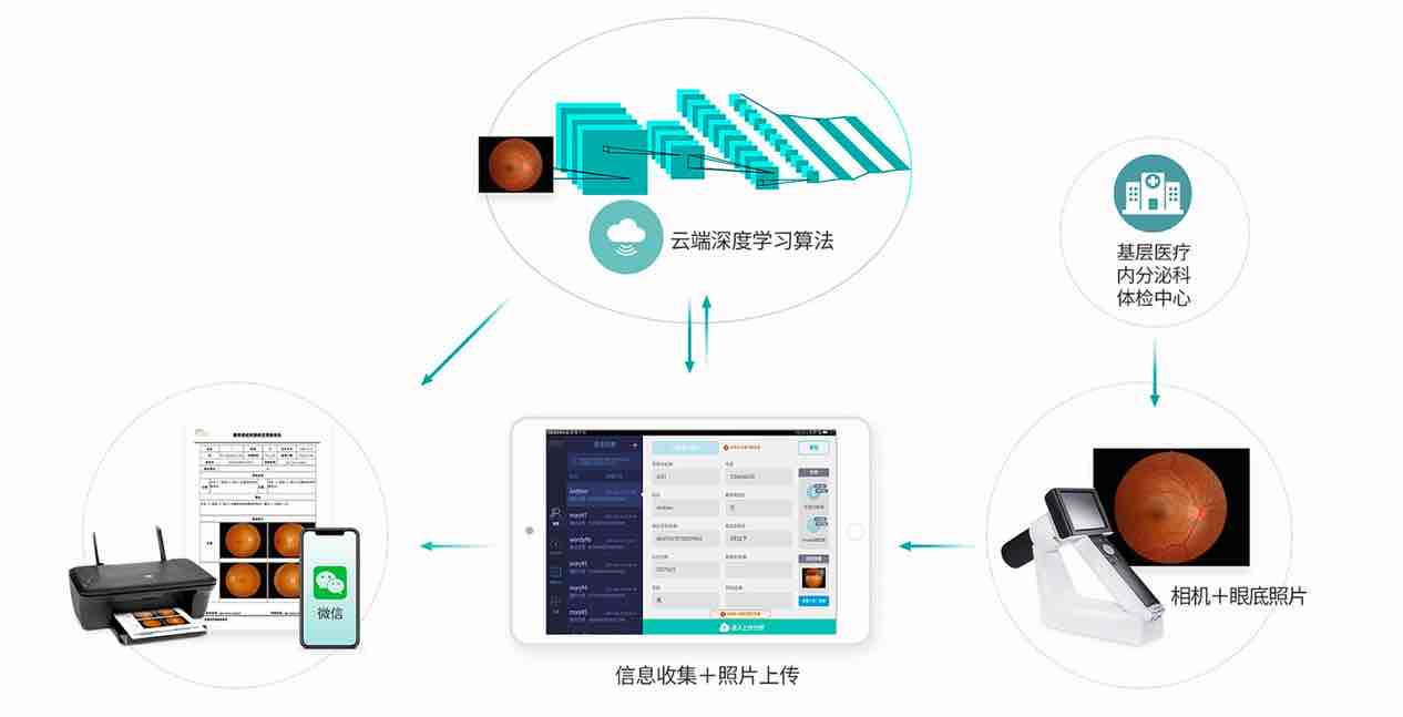 深圳硅基智能:成功获中国首批糖网筛查AI辅助诊断软件三类证-肽度TIMEDOO