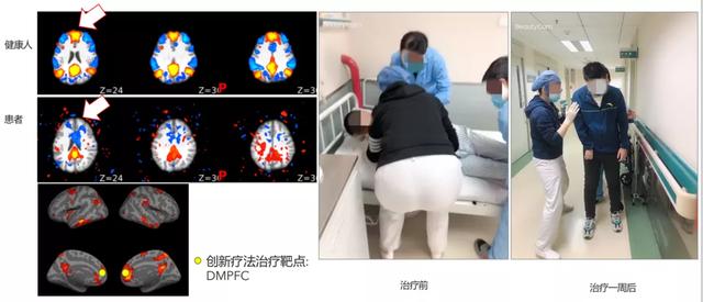 MIT和哈佛顶尖中国脑科学家回国创业,创建脑疾病平台!已部署多家三甲医院-肽度TIMEDOO