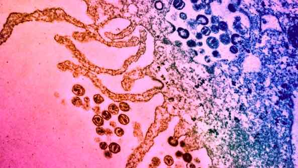 密歇根大学医学院: 抗生素分子帮助免疫系统杀死HIV感染的细胞