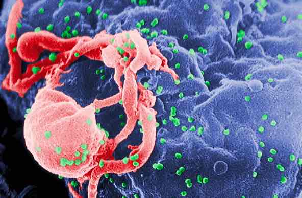 密歇根大学医学院: 抗生素分子帮助免疫系统杀死HIV感染的细胞-肽度TIMEDOO