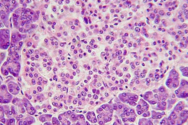 Nature Metabolism:皮下移植胰岛细胞治疗糖尿病-肽度TIMEDOO