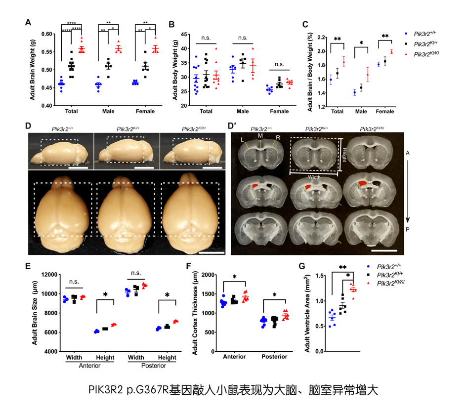 厦门大学联合哈佛大学发文:PIK3R2的激活突变导致脑过度生长及脑电异常-肽度TIMEDOO